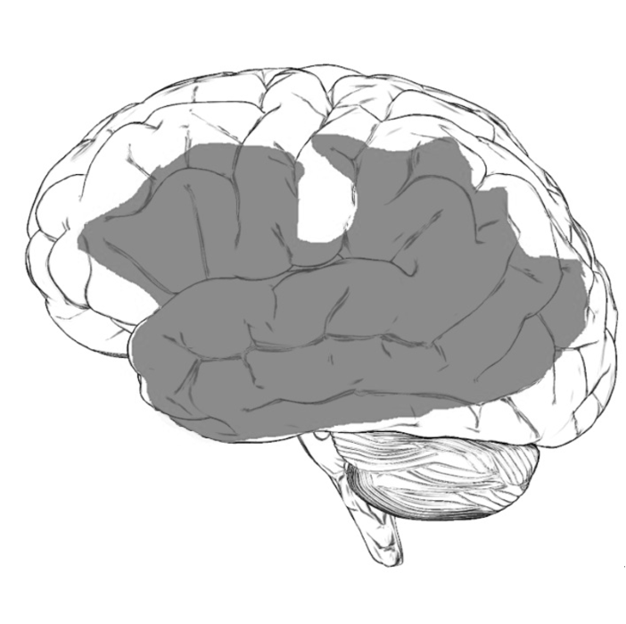 Machine-Aided Keyword Suggestions for Aphasic Speech